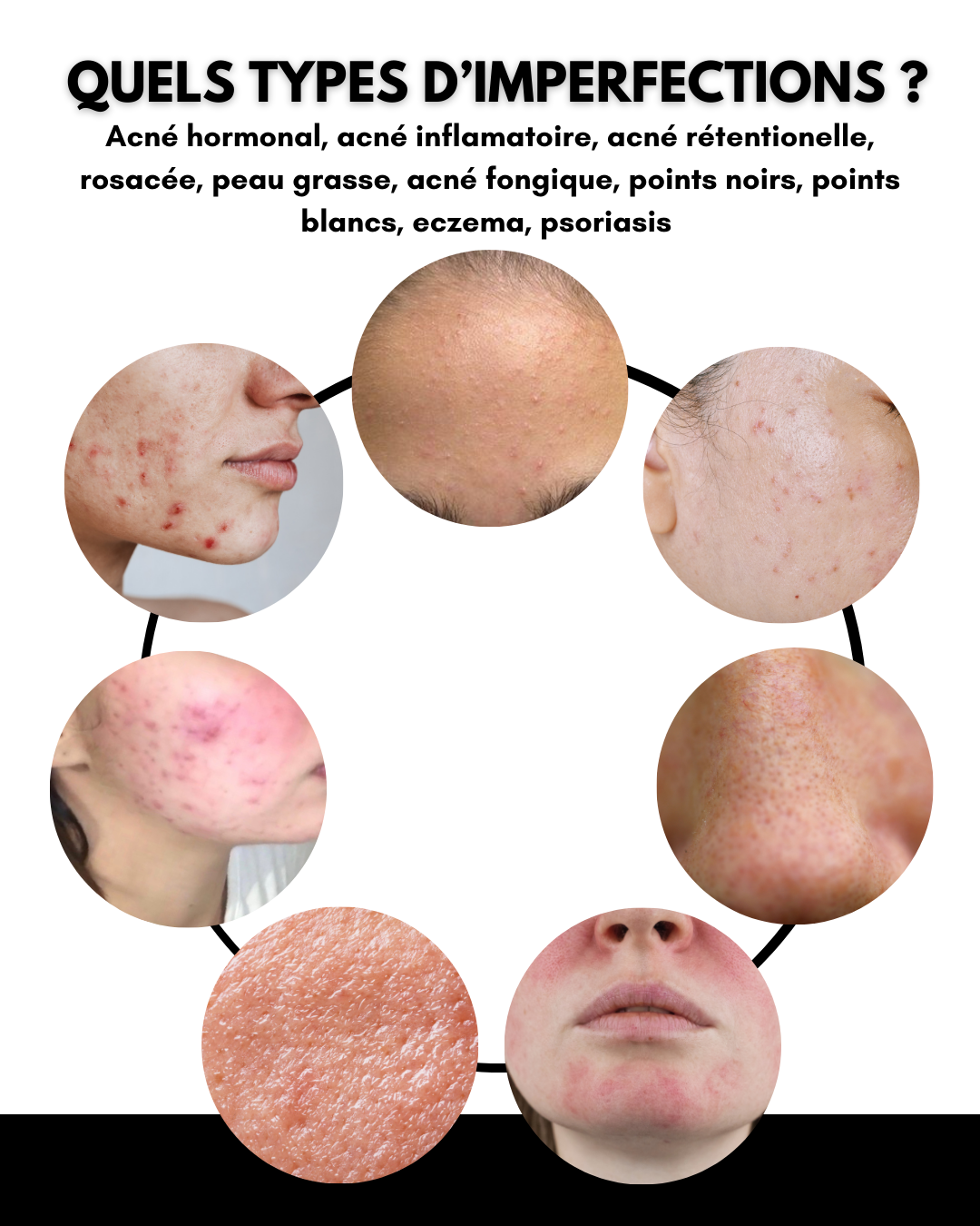 Combo Anti-Imperfections